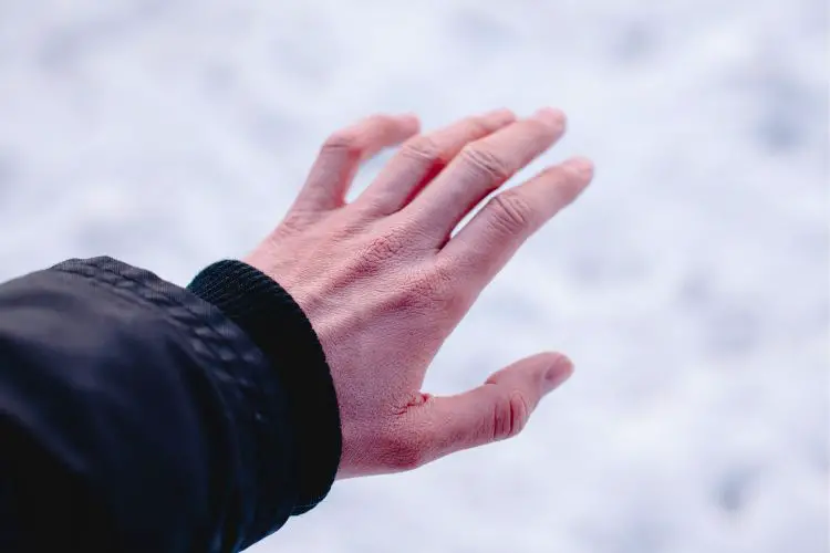 frostbite of hand in winter